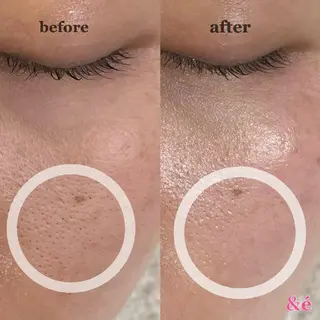 &é(アンドイー)所属・【&é アンドイー】 河本絵美のその他イメージ