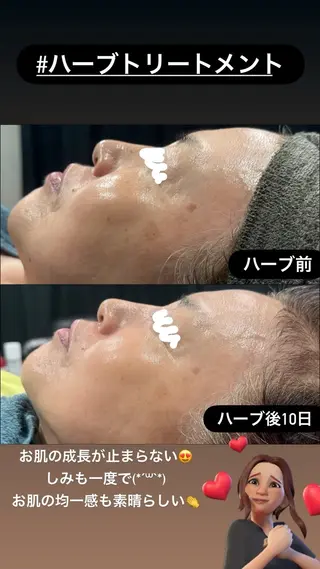 LiZA エステティックサロンのエステ・リラクイメージ