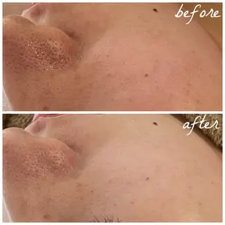 メンズ メナード岐阜茜部 杉浦のエステ・リラクイメージ