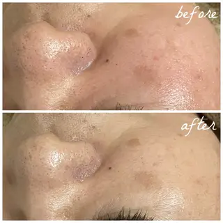 メンズ メナード岐阜茜部 杉浦のエステ・リラクイメージ