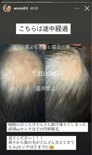 private salon Dea_maris シュガーリング&パーソナルボディケア所属・シミ改善・韓国肌管理 ボディメイク痩身のその他イメージ