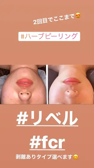 FLEUR大阪・整体 ・ハイフ・痩身・小顔のエステ・リラクイメージ