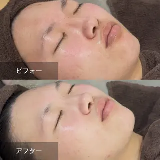 美sorciere所属・現役看護師サロン めぐみのエステ・リラクイメージ