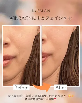 les SALON所属・les SALON／ 痩身／首肩こり／脱毛のエステ・リラクイメージ