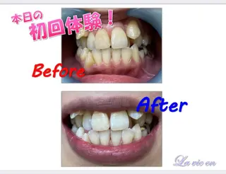 セルフホワイトニングサロン　ラヴィアン所属・ホワイトニングサロン La vie enのその他イメージ