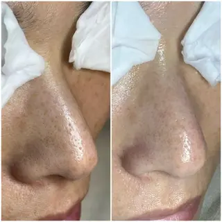 マツヤニWax専門/ 岸和田/Luanaのエステ・リラクイメージ