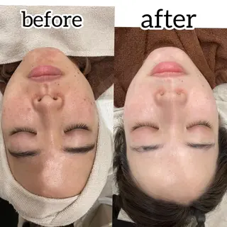 laluna saki...のその他イメージ