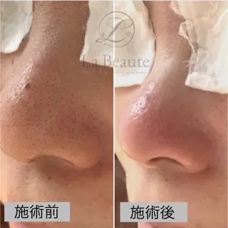 Naturally ナチュラリーのマツエク・マツパデザイン