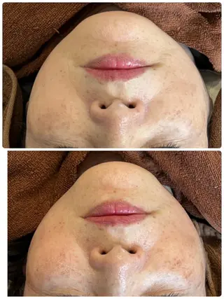 FLEUR大阪・整体 ・ハイフ・痩身・小顔のエステ・リラクイメージ