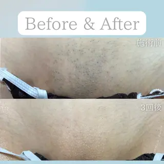 美肌脱毛&毛穴専門 Nico🐰ྀི♡のエステ・リラクイメージ