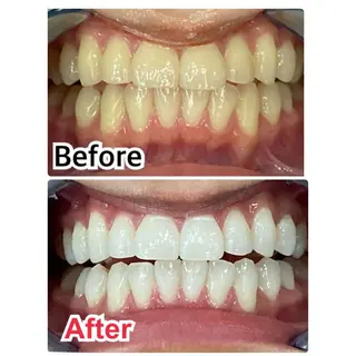 ミディアム メンズ キッズ ネイル マツエク・マツパ アイブロウ プラチナムビューティー柏所属・【歯科提携】柏ホワイ トニングスタイルのその他イメージ