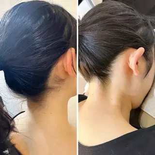 うなじ脱毛/美肌脱毛 LABELのエステ・リラクイメージ