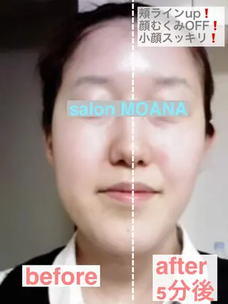 小顔美肌salon MOANAのエステ・リラクイメージ