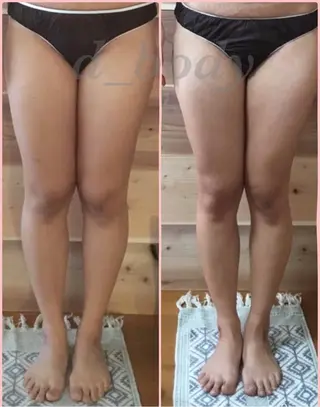 private salon Dea_maris シュガーリング&パーソナルボディケア所属・シミ改善・韓国肌管理 ボディメイク痩身のその他イメージ