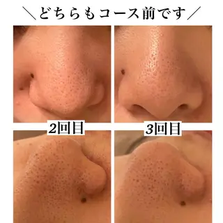 Bellesthe (ベルエステ)のエステ・リラクイメージ