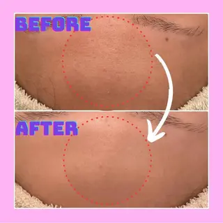 Lily luce 美骨小顔矯正のその他イメージ