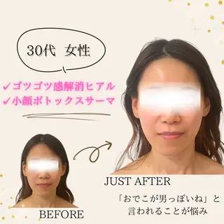 小顔/たるみ/黒ずみ除去専門サロン/SONA 大和西大寺店所属・【小顔専門看護師 サロンSONA】のエステ・リラクイメージ