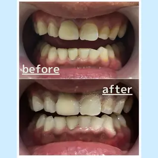 メンズ お手軽ホワイトニングsalon mina所属・武元 奈津美のその他イメージ