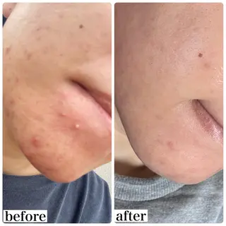 WHITE AQUA 北千住店のエステ・リラクイメージ