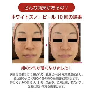 RinRin 山口店のエステ・リラクイメージ