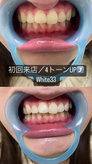 メンズ セルフホワイトニング White33大名のその他イメージ