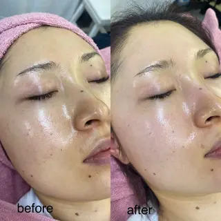 siro スタッフのエステ・リラクイメージ