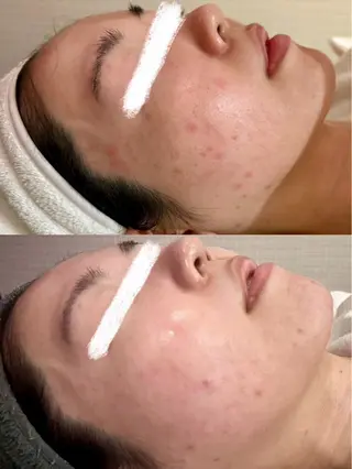 Grandir所属・ハーブピーリング専門 グランディール　武内のエステ・リラクイメージ