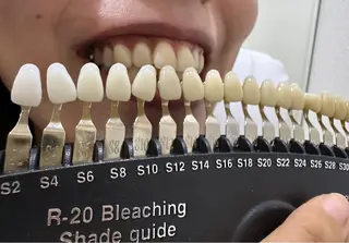 ホワイトニングジム 池袋のその他イメージ