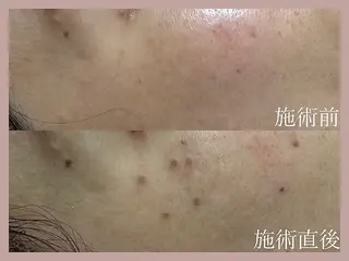 シミたるみケア リラク リタ池尻大橋のエステ・リラクイメージ