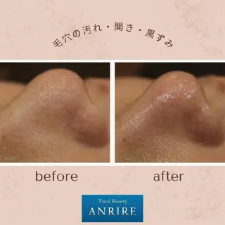 ANRIRE (アンリール)のエステ・リラクイメージ