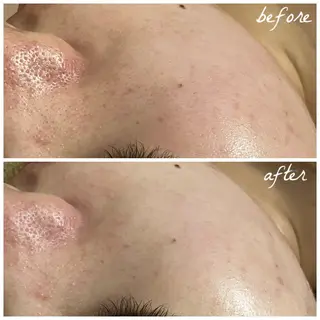 メンズ メナード岐阜茜部 杉浦のエステ・リラクイメージ