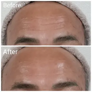 メンズ 肌質改善Beauty salon Renのエステ・リラクイメージ