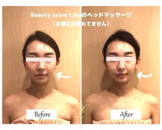 痩身×フェイシャル ブライダル|Linoのエステ・リラクイメージ