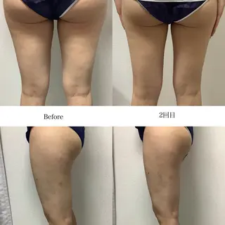 冷却専門店 SLARIのエステ・リラクイメージ