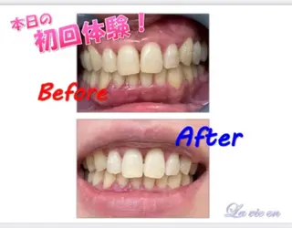 セルフホワイトニングサロン　ラヴィアン所属・ホワイトニングサロン La vie enのその他イメージ