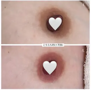 本気で痩せたい方へ 痩身専門サロンのその他イメージ