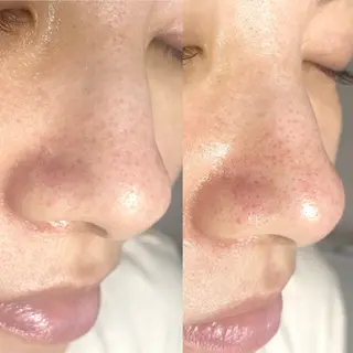 mone~total care salon~所属・mone (モーネ)のマツエク・マツパデザイン