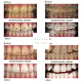 ホワイトニングショップ伊丹店所属・ホワイトニング ショップ伊丹店のその他イメージ