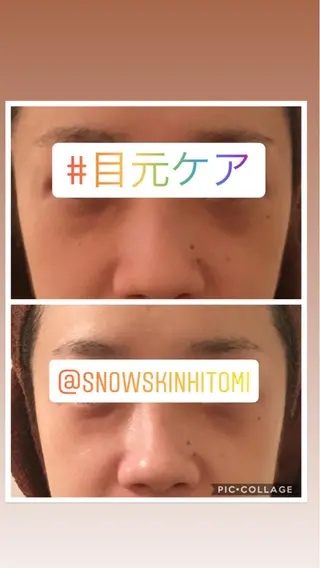 ニキビ/肌質改善専門 Snow skinのエステ・リラクイメージ