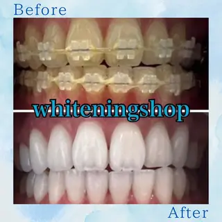 ホワイトニング ショップ葛西店のその他イメージ