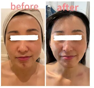 久屋大通フェイシャル エステ　POLAのエステ・リラクイメージ