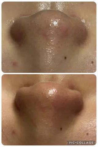 筋膜フェイシャル UruSALON🌿のエステ・リラクイメージ