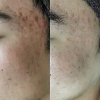 ニキビ改善専門店 d'Albaのエステ・リラクイメージ