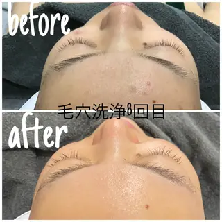 毛穴洗浄・痩身・脱毛 /アルカンジュのエステ・リラクイメージ