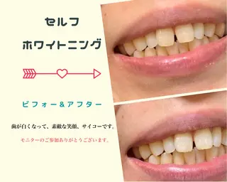 整体フェイシャル EMINALのエステ・リラクイメージ