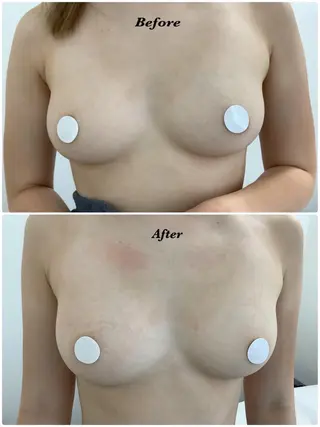 🩵Tatsumi Kana🩵のエステ・リラクイメージ