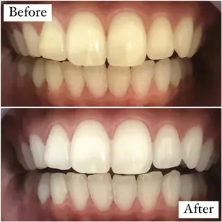 LBSホワイトニング 銀座店💎スタッフ峯のその他イメージ