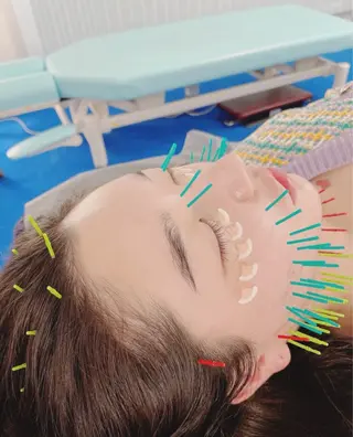 小顔美容鍼専門サロン 渋谷YZのエステ・リラクイメージ