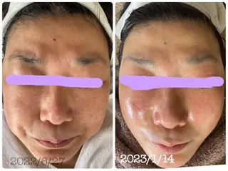 エル美容室所属・oshima yuukiのマツエク・マツパデザイン