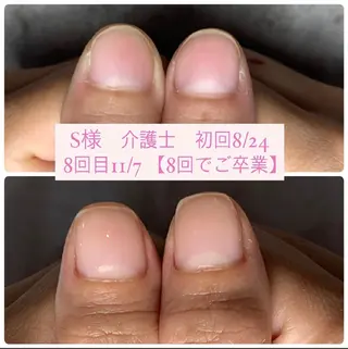 ネイル AKT NAIL所属・AKT Beauty エステヘッドスパのエステ・リラクイメージ